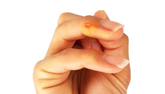 Обработайте рану